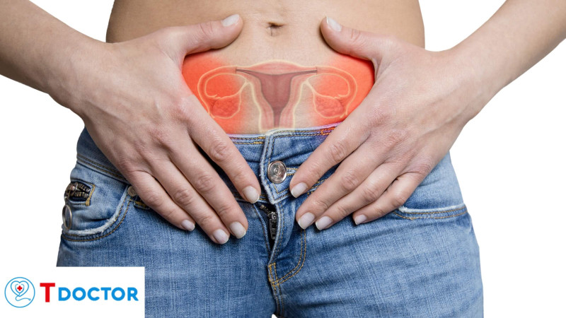 TDOCTOR.VN - Ung thư buồng trứng - dấu hiệu Nguyên nhân, điều trị và phòng ngừa